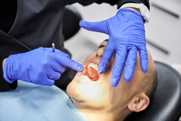 Best Emergency Dentist for Lost Fillings or Crowns in Vevay, IN
